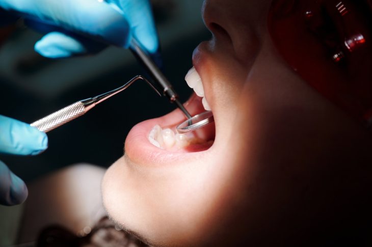 Fluoride Toothpaste